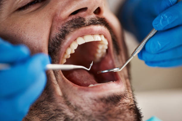 Best Broken or Cracked Tooth Emergency Dentist in Shark River Hills, NJ