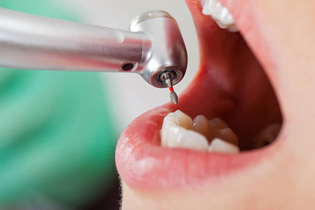 Best Emergency Dentist for Knocked-Out Tooth in Shark River Hills, NJ